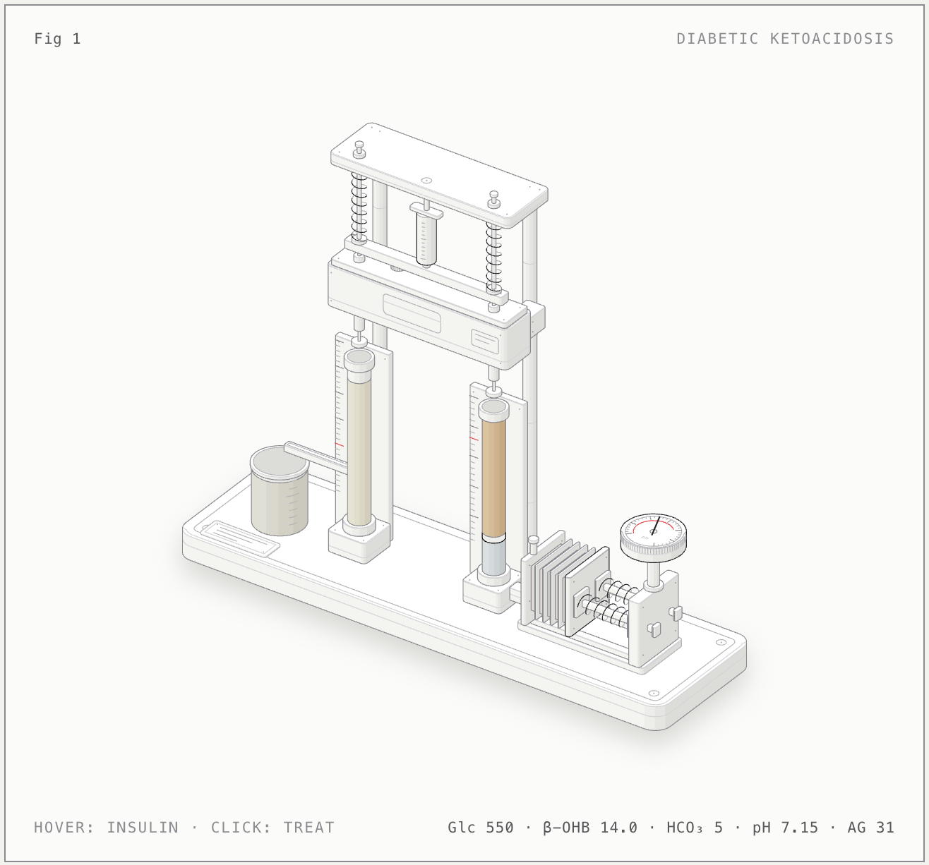 Diabetic ketoacidosis (DKA) illustrated bench model
