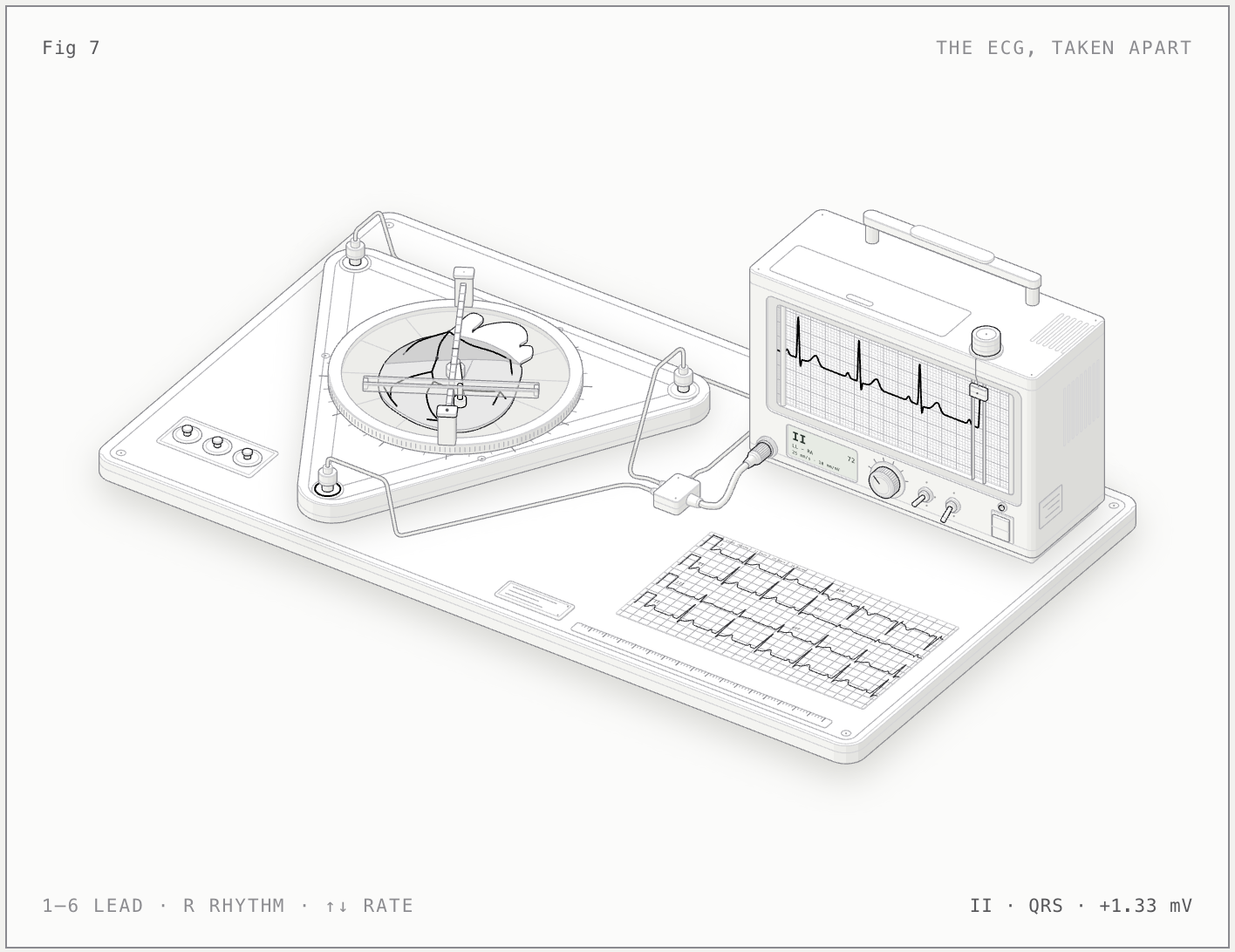 ECG/EKG: The ECG, taken apart illustrated bench model
