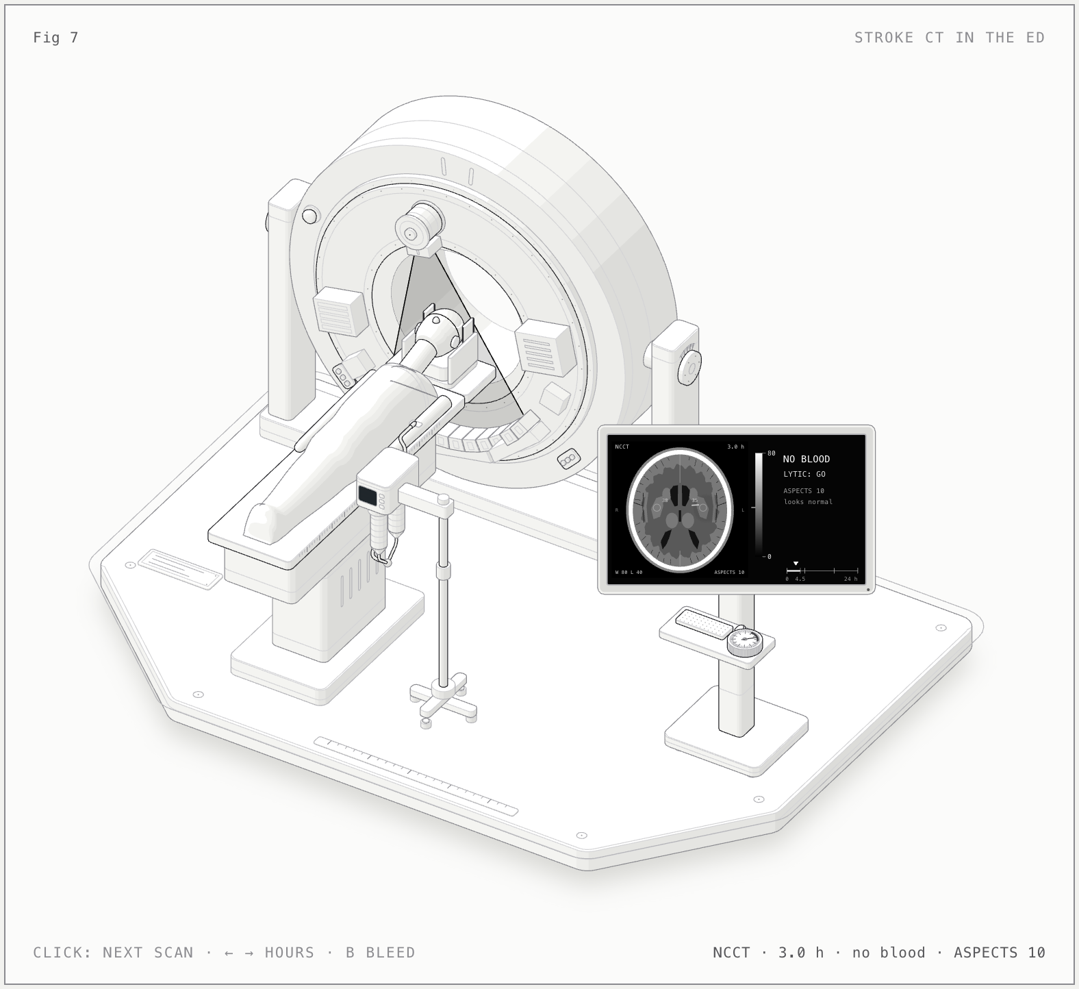Stroke and emergency CT illustrated bench model