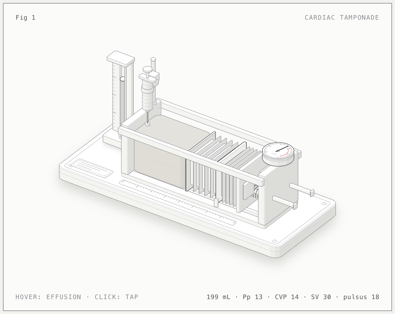 Cardiac tamponade illustrated bench model